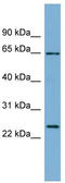 Intermediate Filament Family Orphan 1 antibody, TA333554, Origene, Western Blot image 