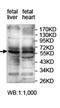 Zinc Finger Protein 454 antibody, orb78117, Biorbyt, Western Blot image 
