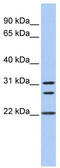 Calponin 1 antibody, TA346544, Origene, Western Blot image 