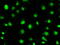 STE20/SPS1-related proline-alanine-rich protein kinase antibody, M02516, Boster Biological Technology, Immunofluorescence image 