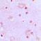 Serine/arginine-rich splicing factor 7 antibody, orb224004, Biorbyt, Immunohistochemistry paraffin image 