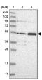 NHS Like 1 antibody, PA5-56312, Invitrogen Antibodies, Western Blot image 
