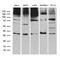 Ring Finger Protein 4 antibody, M02875-1, Boster Biological Technology, Western Blot image 