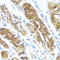 Nucleoside diphosphate kinase antibody, A08517, Boster Biological Technology, Immunohistochemistry frozen image 