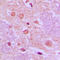 SS18 Subunit Of BAF Chromatin Remodeling Complex antibody, LS-C352876, Lifespan Biosciences, Immunohistochemistry paraffin image 