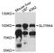 SLIT And NTRK Like Family Member 4 antibody, LS-C748007, Lifespan Biosciences, Western Blot image 