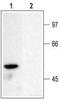 Potassium Voltage-Gated Channel Subfamily A Member 6 antibody, TA328923, Origene, Western Blot image 