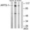 Endoplasmic Reticulum Aminopeptidase 1 antibody, A02021, Boster Biological Technology, Western Blot image 