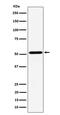 Neuropeptide Y Receptor Y5 antibody, M06337, Boster Biological Technology, Western Blot image 