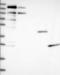 Diphthamine Biosynthesis 6 antibody, NBP1-91691, Novus Biologicals, Western Blot image 
