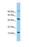 Fatty Acid Binding Protein 5 antibody, NBP1-98462, Novus Biologicals, Western Blot image 