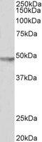 Potassium Voltage-Gated Channel Subfamily J Member 6 antibody, A04558, Boster Biological Technology, Western Blot image 