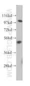 2'-5'-Oligoadenylate Synthetase 1 antibody, 14955-1-AP, Proteintech Group, Western Blot image 