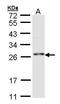 RING finger protein 114 antibody, TA308636, Origene, Western Blot image 
