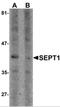 Septin 1 antibody, NBP2-81892, Novus Biologicals, Western Blot image 