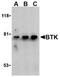 Bruton Tyrosine Kinase antibody, TA306188, Origene, Western Blot image 
