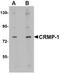 Dihydropyrimidinase-related protein 1 antibody, NBP1-76982, Novus Biologicals, Western Blot image 