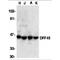 DNA Fragmentation Factor Subunit Alpha antibody, TA305956, Origene, Western Blot image 