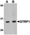 Leptin Receptor antibody, orb6313, Biorbyt, Western Blot image 