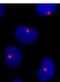 5-azacytidine-induced protein 1 antibody, NB100-68227, Novus Biologicals, Immunocytochemistry image 