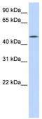 CCM2 Like Scaffold Protein antibody, TA340238, Origene, Western Blot image 