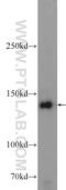 Ski2 Like RNA Helicase antibody, 11462-1-AP, Proteintech Group, Western Blot image 