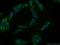 Sperm protein associated with the nucleus on the X chromosome E antibody, 15870-1-AP, Proteintech Group, Immunofluorescence image 