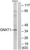 GNAT1 antibody, TA313933, Origene, Western Blot image 