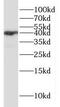 Hydroxymethylbilane Synthase antibody, FNab03918, FineTest, Western Blot image 