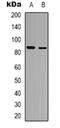 Fibroblast Growth Factor Receptor Substrate 2 antibody, orb318870, Biorbyt, Western Blot image 