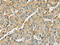 HAT antibody, CSB-PA262991, Cusabio, Immunohistochemistry paraffin image 