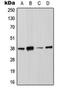 Annexin A2 antibody, orb216015, Biorbyt, Western Blot image 