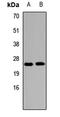Protein S100-A3 antibody, orb412242, Biorbyt, Western Blot image 