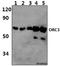 Origin Recognition Complex Subunit 3 antibody, A07377, Boster Biological Technology, Western Blot image 