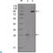 EPH Receptor B2 antibody, LS-C812459, Lifespan Biosciences, Western Blot image 