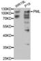 Promyelocytic Leukemia antibody, abx000086, Abbexa, Western Blot image 