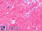 Thy-1 Cell Surface Antigen antibody, LS-B11449, Lifespan Biosciences, Immunohistochemistry frozen image 