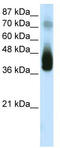 JunB Proto-Oncogene, AP-1 Transcription Factor Subunit antibody, TA330148, Origene, Western Blot image 
