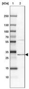 Phosphatidylinositol N-acetylglucosaminyltransferase subunit C antibody, NBP1-86283, Novus Biologicals, Western Blot image 