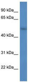 F-box/WD repeat-containing protein 9 antibody, TA342952, Origene, Western Blot image 