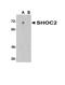 SHOC2 Leucine Rich Repeat Scaffold Protein antibody, A07214, Boster Biological Technology, Western Blot image 