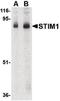 Stromal Interaction Molecule 1 antibody, LS-B1408, Lifespan Biosciences, Western Blot image 