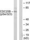 Cell Division Cycle 25B antibody, TA313189, Origene, Western Blot image 
