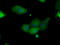 Pim-2 Proto-Oncogene, Serine/Threonine Kinase antibody, TA501166, Origene, Immunofluorescence image 