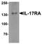 Interleukin 17 Receptor A antibody, A01311, Boster Biological Technology, Western Blot image 