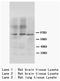 ADAM Metallopeptidase With Thrombospondin Type 1 Motif 4 antibody, AP23310PU-N, Origene, Western Blot image 