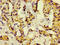 KiSS-1 Metastasis Suppressor antibody, LS-C671976, Lifespan Biosciences, Immunohistochemistry paraffin image 