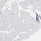 Cyclin-dependent kinase-like 5 antibody, HPA002847, Atlas Antibodies, Immunohistochemistry frozen image 
