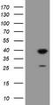 Ubiquitin Conjugating Enzyme E2 J1 antibody, LS-C174104, Lifespan Biosciences, Western Blot image 