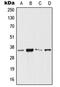 Homeobox protein SIX3 antibody, GTX55892, GeneTex, Western Blot image 